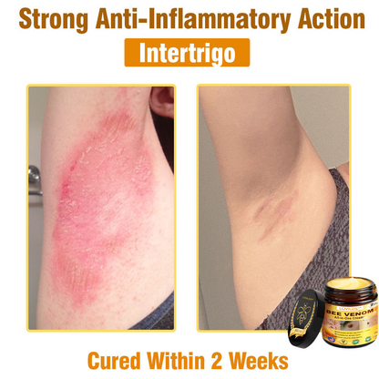 LOVILDS™ Bee Venom Cream – 🌸 Anti-Aging, Hydrating & Skin Repair